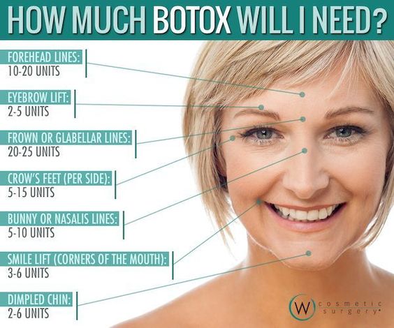 Botox Injections, Purpose, Procedure, Risks, Results